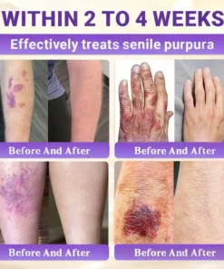 Alisanda® Biotin 10-in-1 Skin Restoration Cream