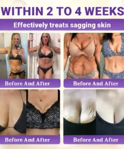 Alisanda® Biotin 10-in-1 Skin Restoration Cream