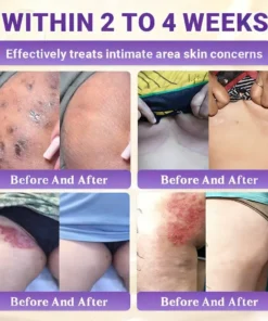 Alisanda® Biotin 10-in-1 Skin Restoration Cream