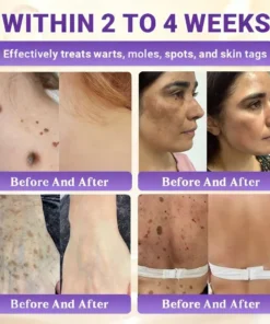 Alisanda® Biotin 10-in-1 Skin Restoration Cream