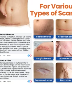 Alisanda® DermalRebuild Daily Renewal Gel