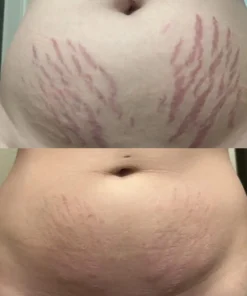 Alisanda® DermalRebuild Daily Renewal Gel