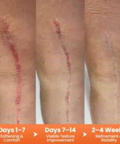 Alisanda® DermalRebuild Daily Renewal Gel