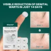 Alisanda® Magnesium MicroPin HPV Genital Wart Removal Patch