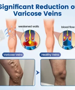 Alisanda® Vein Ease Microneedle Therapy Patch