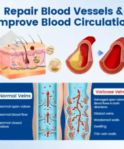 Alisanda® Vein Ease Microneedle Therapy Patch