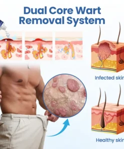 Alisanda® WartRelief Cream | Say goodbye to itching quickly