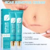 Alisanda Scar Repair Cream