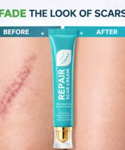 Alisanda Scar Repair Cream