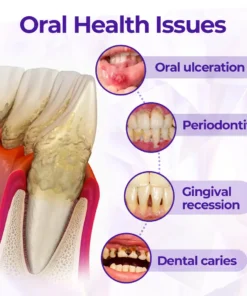 Alisanda® SensiGum Fluoride Toothpaste