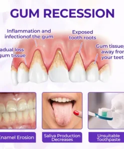 Alisanda® SensiGum Fluoride Toothpaste