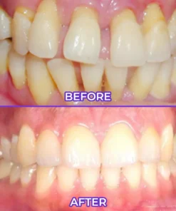 Alisanda® SensiGum Fluoride Toothpaste