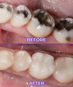 Alisanda® SensiGum Fluoride Toothpaste