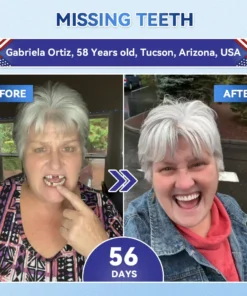 Alisanda® Tideglusib Fast‑Dissolving Tooth & Gum Repair Oral Strips