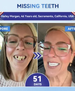 Alisanda® Tideglusib Fast‑Dissolving Tooth & Gum Repair Oral Strips