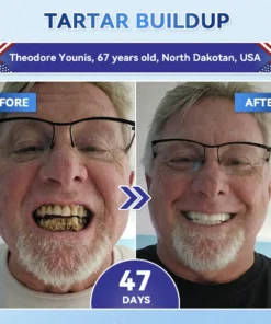 Alisanda® Tideglusib Fast‑Dissolving Tooth & Gum Repair Oral Strips