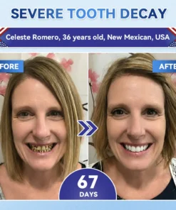 Alisanda® Tideglusib Fast‑Dissolving Tooth & Gum Repair Oral Strips