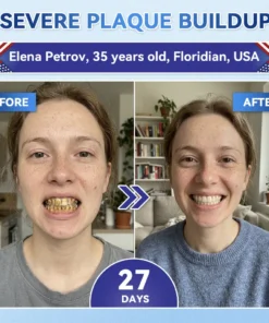 Alisanda® Tideglusib Fast‑Dissolving Tooth & Gum Repair Oral Strips