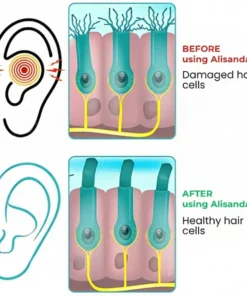 Alisanda® Tinnitus Relieving Device