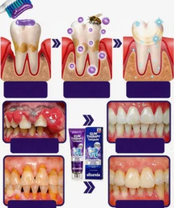 Alisanda® VioCore Dental Treatment Toothpaste