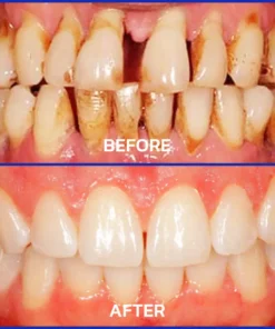 Alisanda® VioCore Dental Treatment Toothpaste