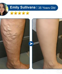 Alisanda® Vein Relief Patch｜Smoother-Looking Legs