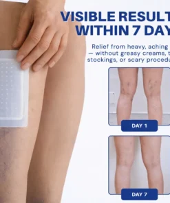 Alisanda® Vein Relief Patch｜Smoother-Looking Legs