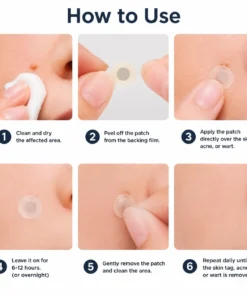 Alisanda®2-in-1 Microneedle & Hydrocolloid Patch