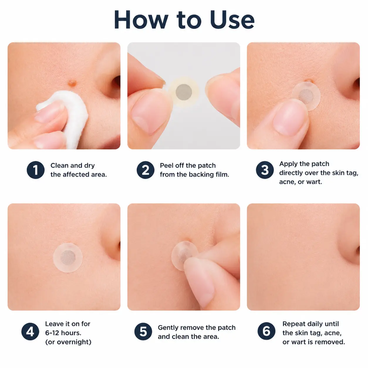 Alisanda®2-in-1 Microneedle & Hydrocolloid Patch