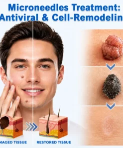 Alisanda®2-in-1 Microneedle & Hydrocolloid Patch
