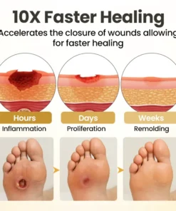 Alisanda® GlucaVeil 24H Foot Barrier Spray