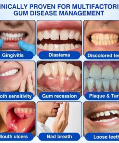 Alisanda® GumRevive Periodontal Repair Gel