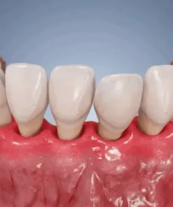 Alisanda® GumRevive Periodontal Repair Gel