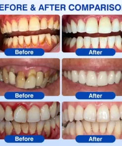 Alisanda® GumRevive Periodontal Repair Gel