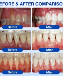 Alisanda® GumRevive Periodontal Repair Gel