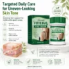 Alisanda® Herbal Vitiligo Cream
