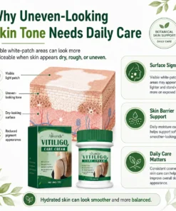 Alisanda® Herbal Vitiligo Cream