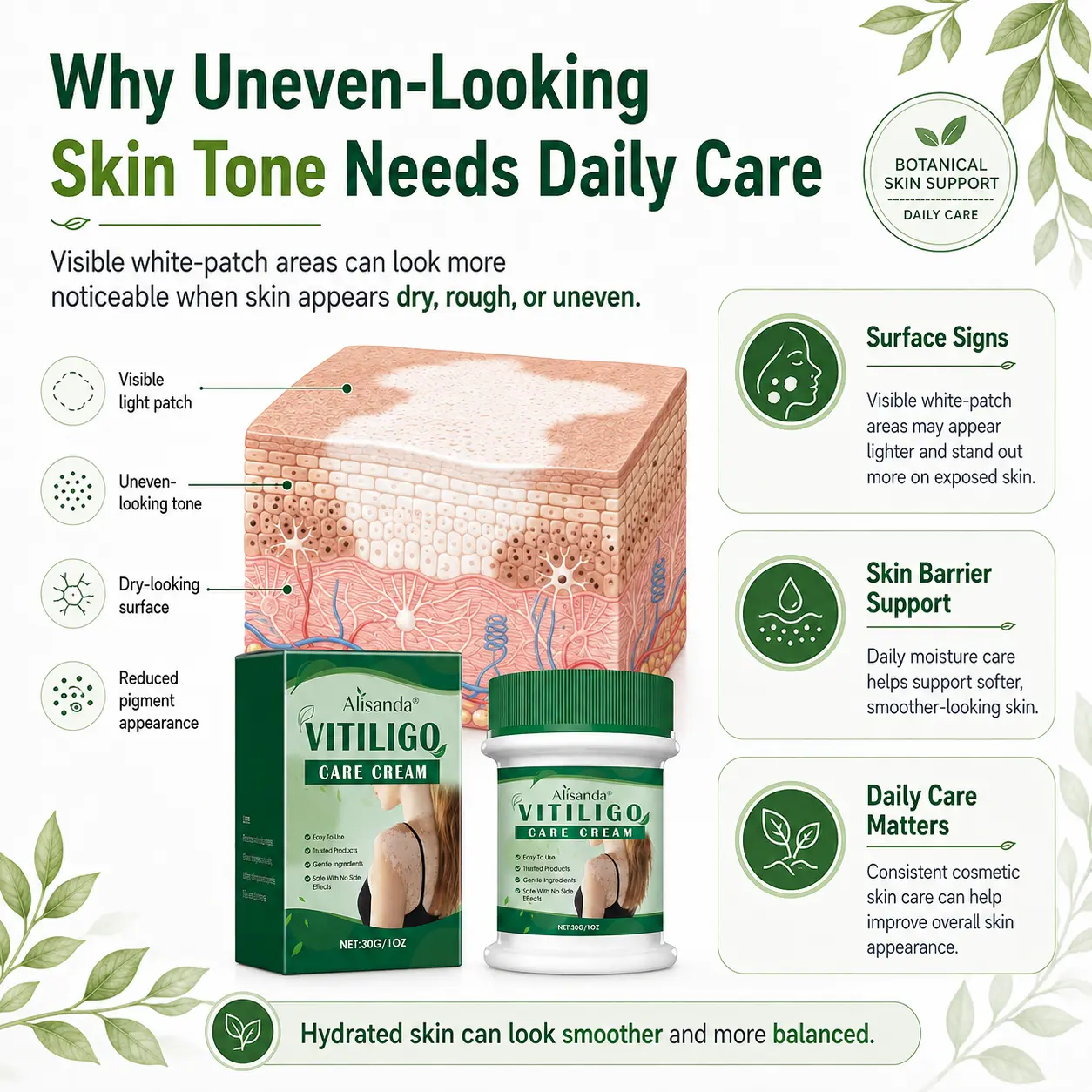 Alisanda® Herbal Vitiligo Cream