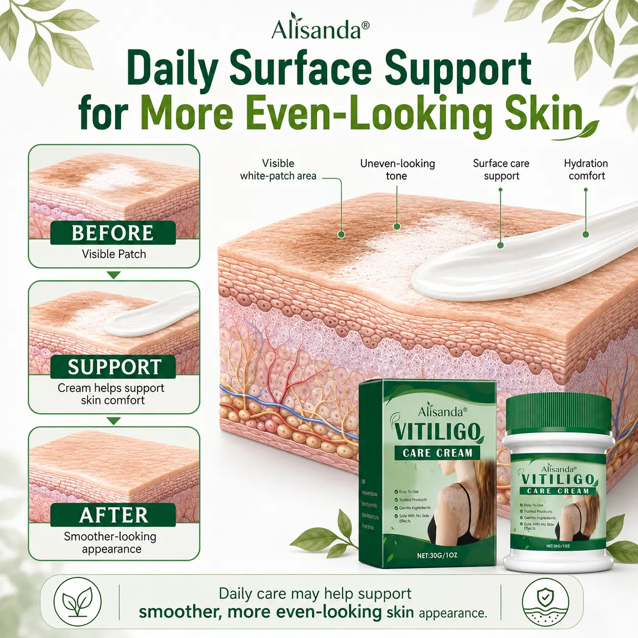 Alisanda® Herbal Vitiligo Cream
