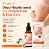 Alisanda® SilkStretch Natural Stretch Mark & Scar Oil