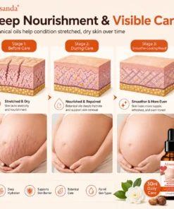 Alisanda® SilkStretch Natural Stretch Mark & Scar Oil