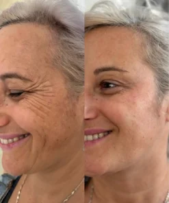 Alisanda® 𝑷𝑫𝑹𝑵 𝑨𝒏𝒕𝒊-𝑨𝒈𝒊𝒏𝒈 & 𝑻𝒂𝒓𝒈𝒆𝒕𝒆𝒅 𝑺𝒑𝒐𝒕 𝑹𝒆𝒏𝒆𝒘𝒂𝒍 𝑺𝒕𝒊𝒄𝒌