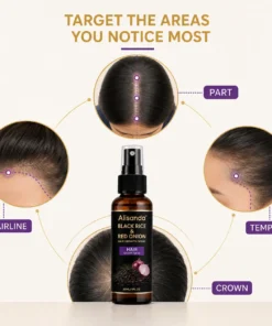 Alisanda® Black Rice & Red Onion Hair Growth Spray