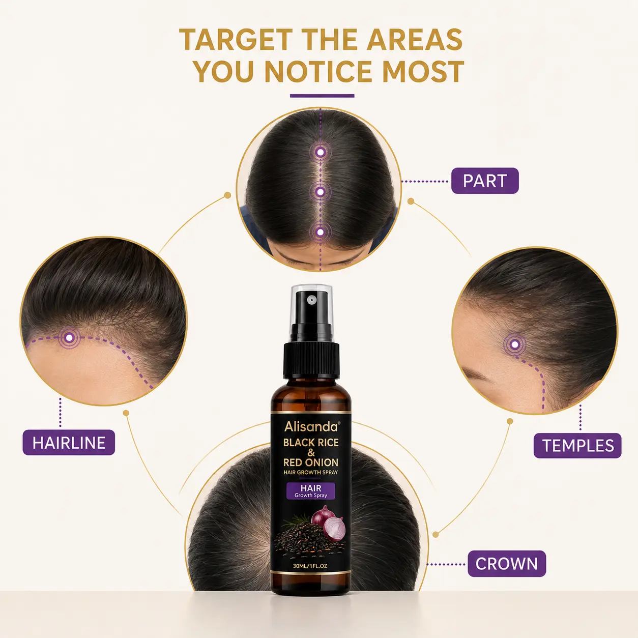 Alisanda® Black Rice & Red Onion Hair Growth Spray