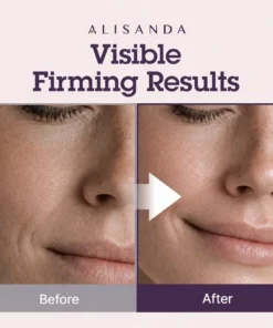 Alisanda® NeckRenew Anti-Aging Firming Cream