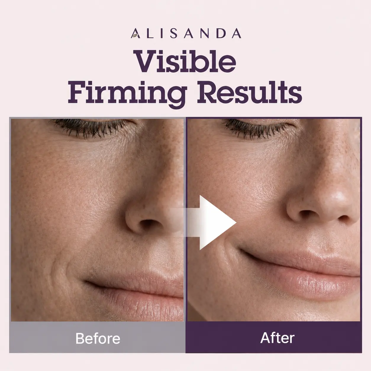 Alisanda® NeckRenew Anti-Aging Firming Cream